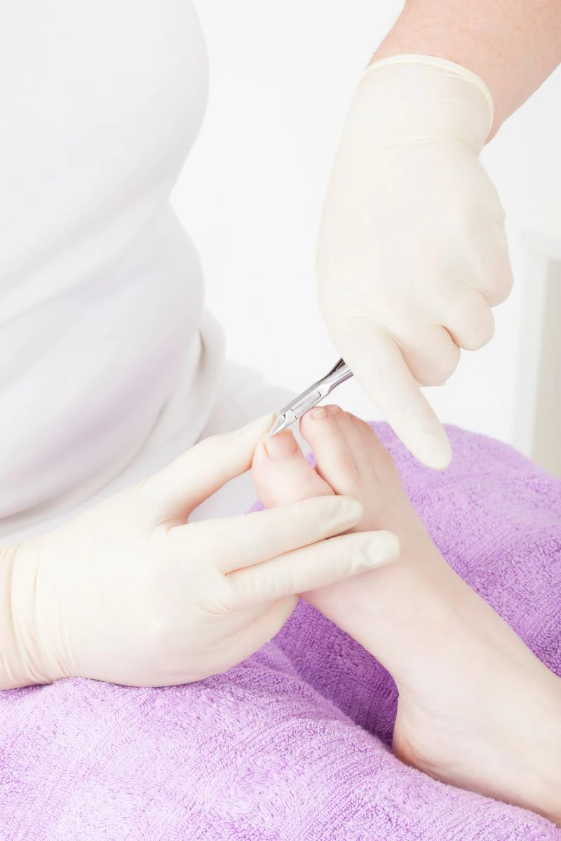 Reid Podiatry - leading podiatrists in Staffordshire, for toenail cutting, corns and calluses. 