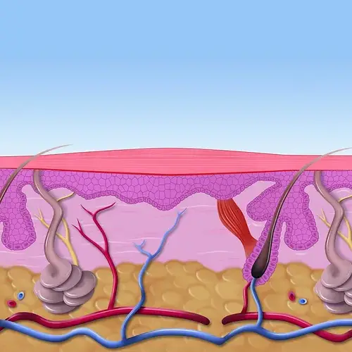 verruca infection treatment with Swift Microwave 